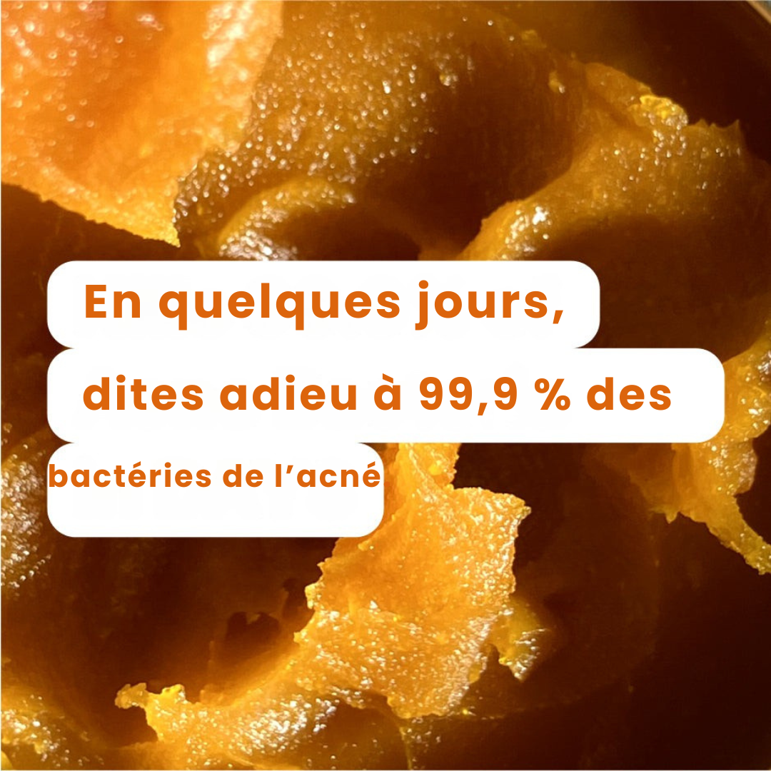 Rituel Anti-Acné 3-en-1